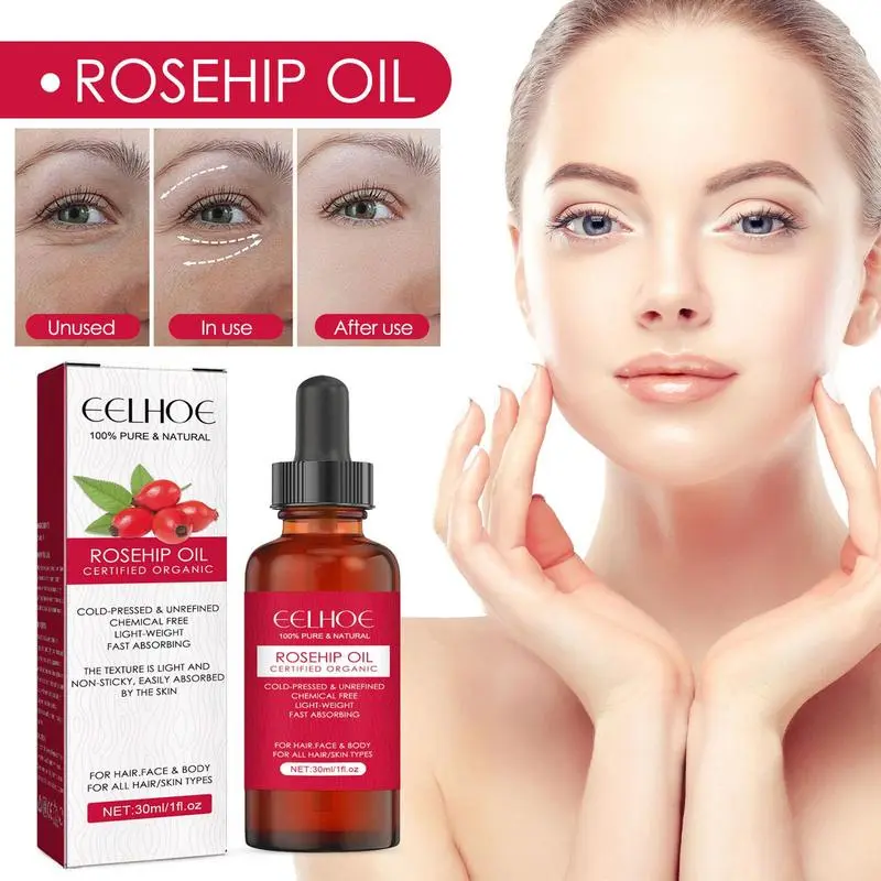 Cold Pressed Rose Hip - 페이스 용 30ml 유기농 로즈 히프